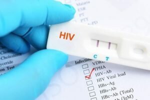 Cara Tes Hiv Sendiri